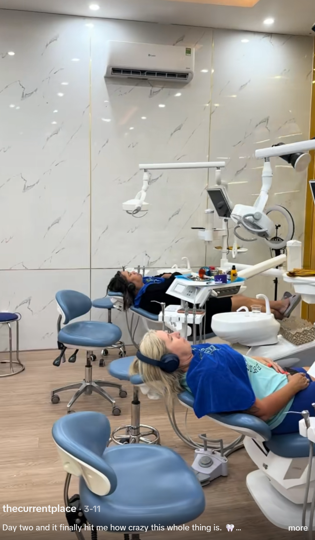 Two patients treated simultaneously in the same open treatment bay with no physical separation between chairs. Aerosol-generating dental procedures — drilling, irrigation, air-water syringe use — produce contaminated aerosol with a radius of approximately 1.5 metres. At the chair separation visible here, each patient is within the aerosol field of the other patient's procedure. There is no isolation screening between the chairs.