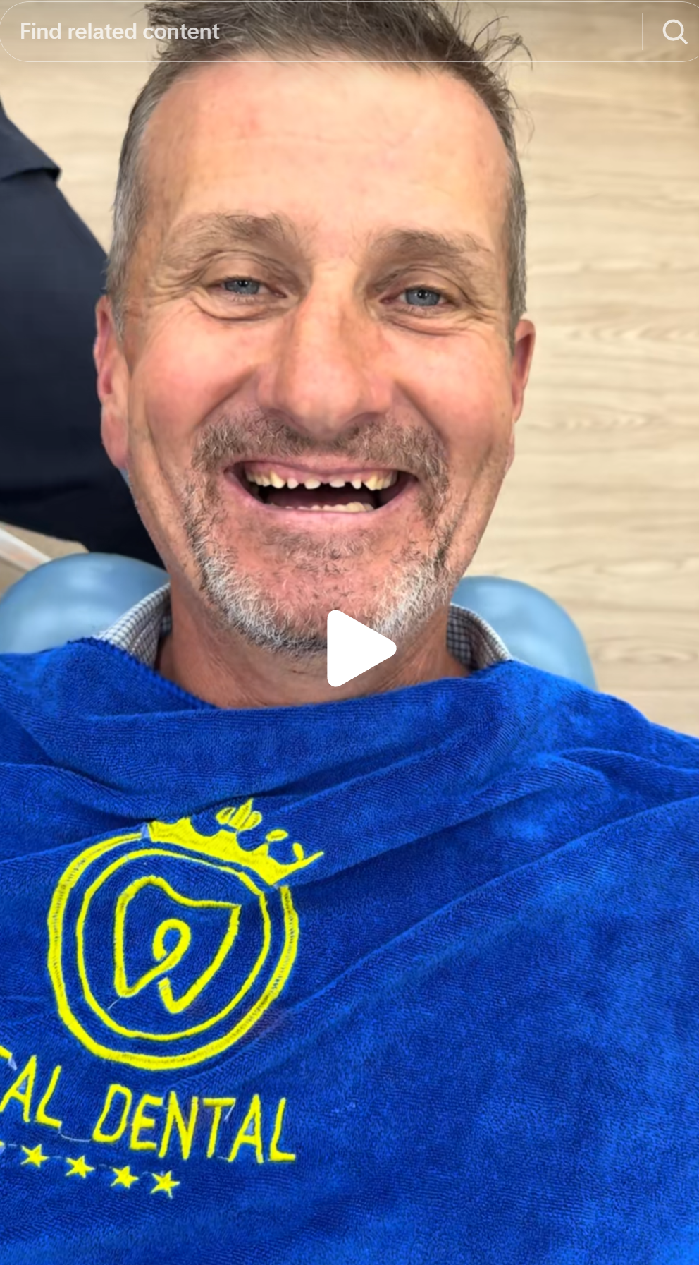 Patient 1: anterior teeth prepared to circumferential stubs. The residual tooth structure is minimal. What was done is irreversible.